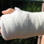 Comment se soigne une fracture du bras ?